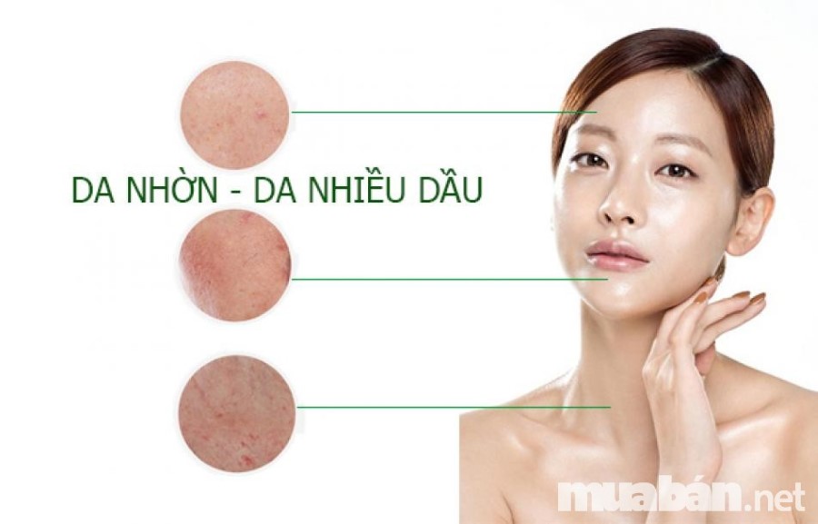 Da dầu thường có lỗ chân lông to và dễ nổi mụn