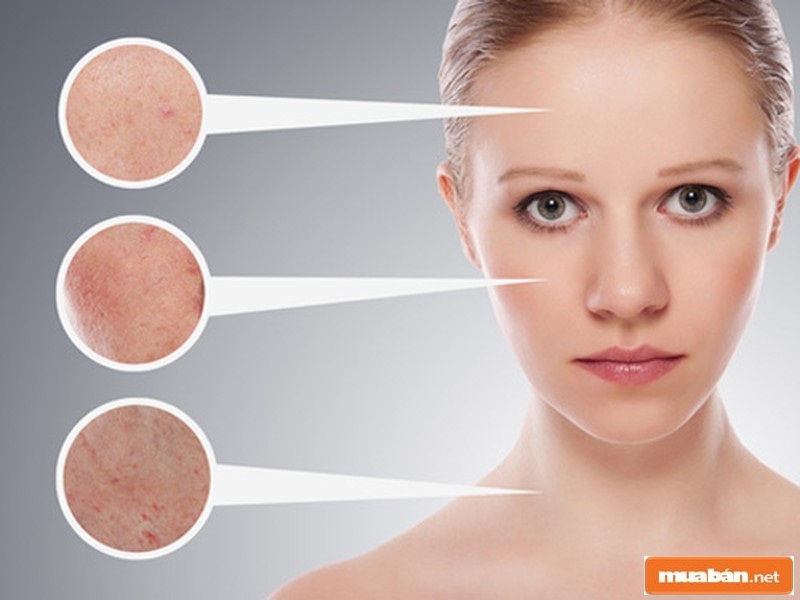 Toner Là Gì? Sản Phẩm Này Có Thật Sự Cần Cho Da Không? 3 Toner Giúp Làm Sạch Sâu Và Thu Nhỏ Lỗ Chân Lông Khá Hiệu Quả