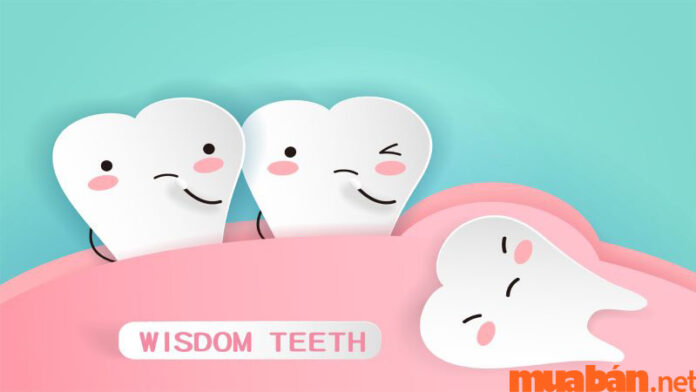 Cách giảm đau khi mọc răng khôn hiệu quả, xua tan 