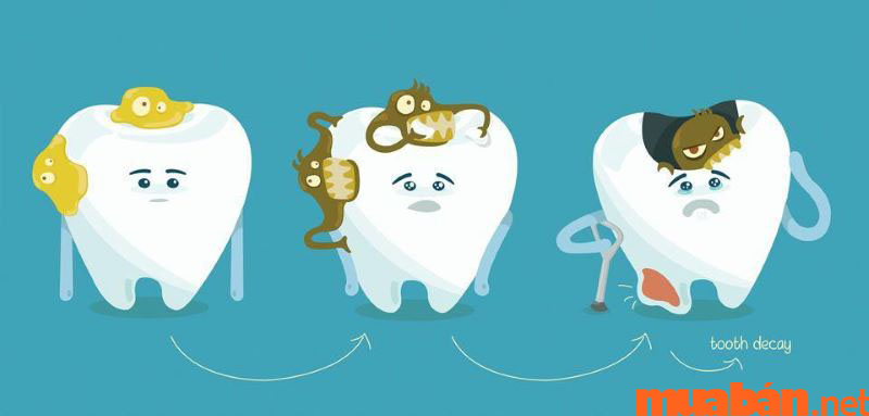 Cách giảm đau khi mọc răng khôn