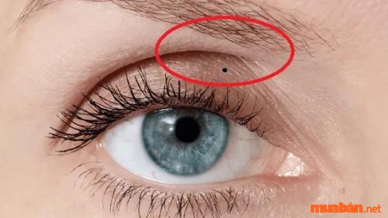 Nốt ruồi trên mí mắt có ý nghĩa gì?