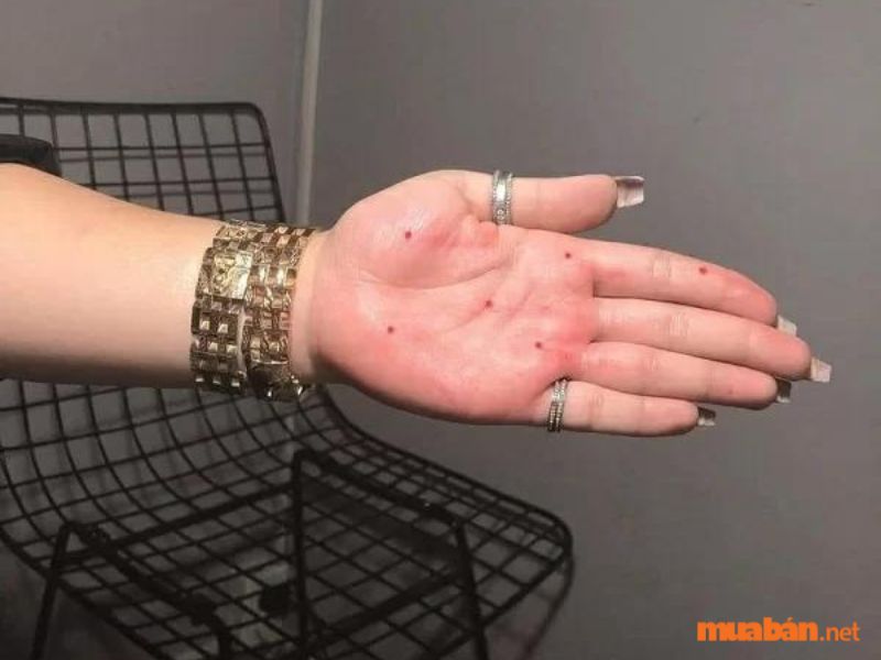 Có nên xăm nốt ruồi ở lòng bàn tay để đem lại may mắn?