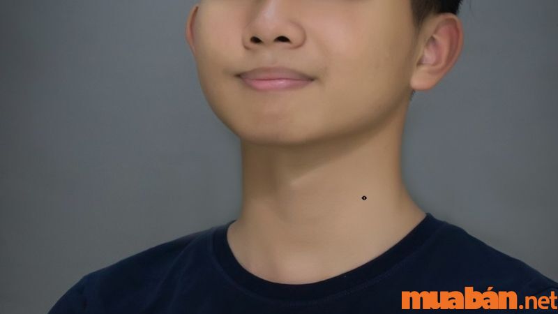 Nốt ruồi ở bên trái cổ nam giới có ý nghĩa gì?