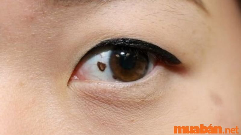 Ý nghĩa của nốt ruồi trong mắt trái phụ nữ