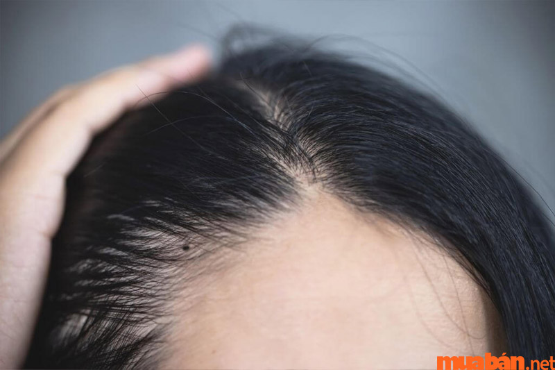 Kiểu tóc đẹp cứu cánh cho nam giới có xoáy trán | Phụ Nữ & Gia Đình